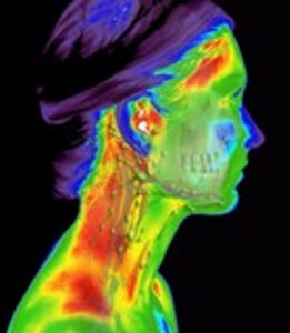 infrarot-medizinische-thermografie-kopf-rechts