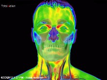 infrarot-medizinische-thermografie-kopf1