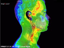 infrarot-medizinische-thermografie-kopf2