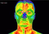 infrarot-medizinische-thermografie-kopf3