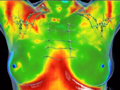 infrarot-medizinische-thermografie-mamma-screening