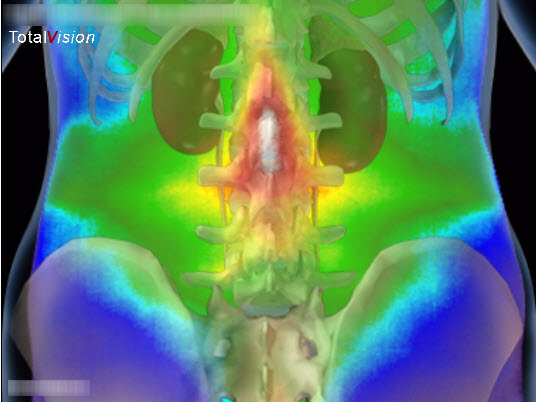 infrarot-medizinische-thermografie-rucken