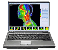 infrarot-medizinische-thermografie