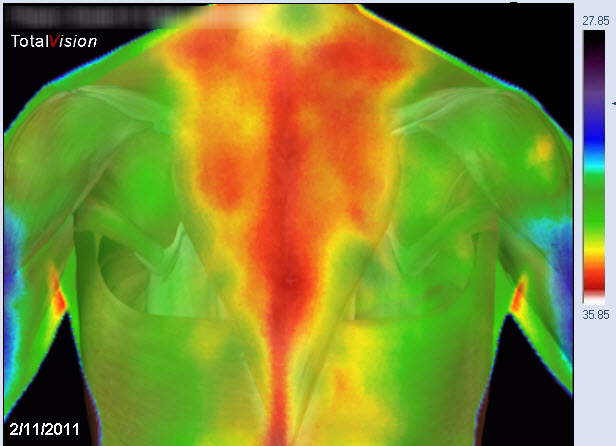 infrarot-medizinische-thermografie-traps