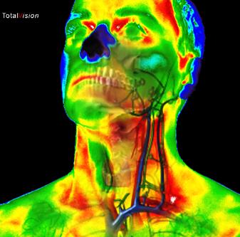 Die Zukunft der medizinischen Thermografie hat begonnen!